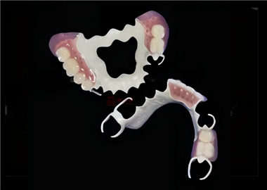 Peek  Framewrok  with  teeth